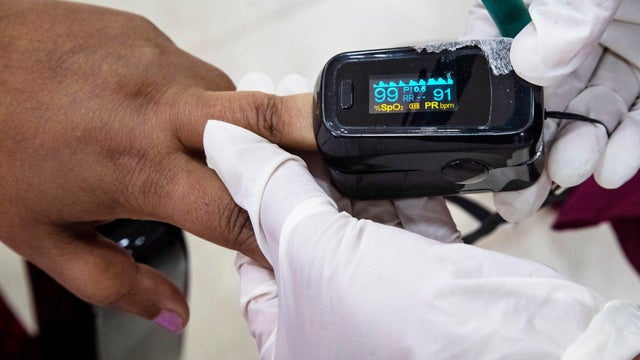 Pulse Oximeters Skin Tones 